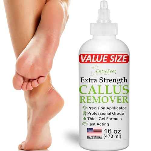 Dr. Entre's 16oz Callus Remover Gel: Extra Strength Value Size, Callus Remover for Feet, Pedicure Tools Supplies, Dead Skin Remover, Foot Care