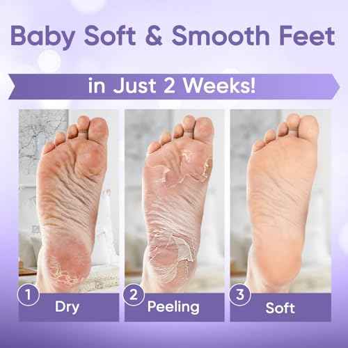 Foot Peel Mask - Foot Mask for Baby Soft Skin - Remove Dead Skin, Dry, Cracked Feet & Callus, Foot Spa, Made with Aloe Vera Extract for Women and Men (2 Pair (Pack of 1), Lavender)