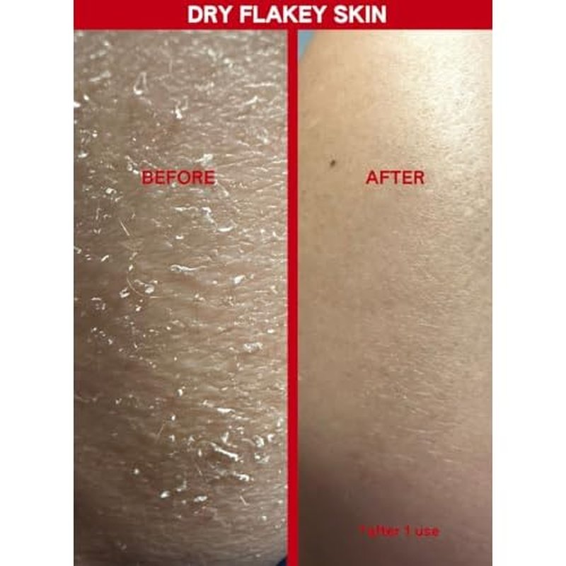 Chemical Body Exfoliant ? 30% AHA + 2% BHA Pre-Shower Body Mask for Smooth, Radiant Skin, Dead Cell Removal & Soft Texture, Glycolic & Salicylic Acid, 150ml