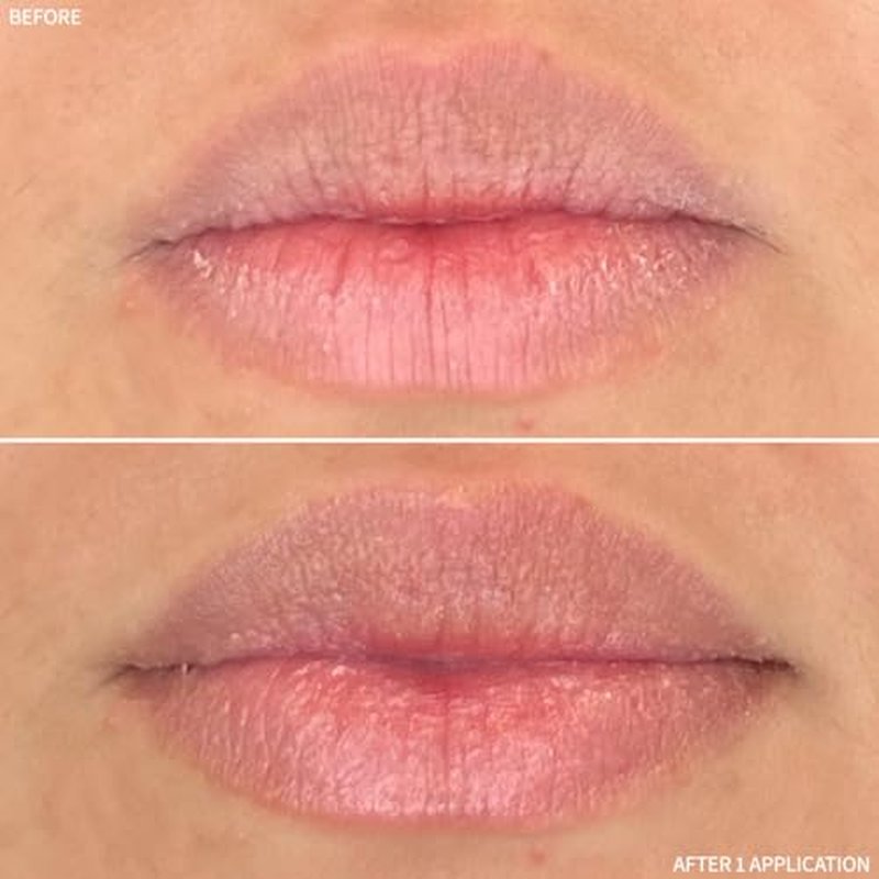 RescueMD Restorative Lip Treatment, Peptide-Powered Rejuvenation + Arnica Repair for Healthy, Hydrated Lips (12mL)