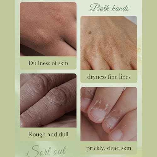 Hand Masks for Dry Cracked Hands - 6 Pairs Avocado Intensive Lotion Moisturizing Gloves - Hydrating Exfoliating Glove Repair Rough Skin - Deep Moisture Spa Hand Masks to Remove Dead Skin Nourishing