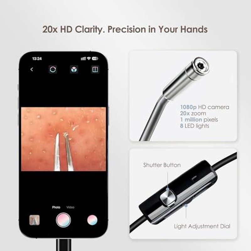 Luma 1 Visual Blackhead Remover Tweezers with Camera - Pimple Popper Tool with Camera 20x Magnification, 1080P, 8 LED Lights, with Blackhead Remover Pimple Popper Tool Kit (6 Piece Kit)