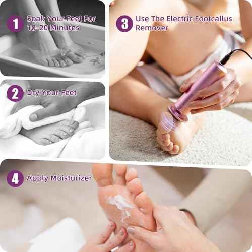 Electric Foot Callus Remover: Feet File Callus Remover with 60pcs Sandpaper Discs - Dead Hard Skin Foot Scrubber for Women -3 Adjustable Speed Pedicure Tools for Feet