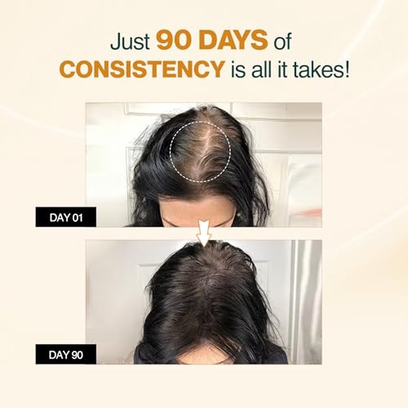Nourish Mantra Advanced Hair Growth Serum 50ml, 3% Redensyl, 2% Anagain, 2% Procapil, 5% Rice Water, Promotes Hair Regrowth, Anti Thinning & Hair Loss Treatment,Rapid Hair Growth Serum for Women & Men