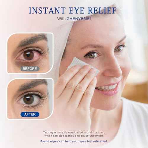 Tea Tree Oil Eyelid Cleansing Wipes, 60 Individually Wrapped Travel Eyelid Wipes With Physiological Saline - Cleanser & Eye Makeup Remover for Dry Eyes, Stye, Blepharitis Treatment