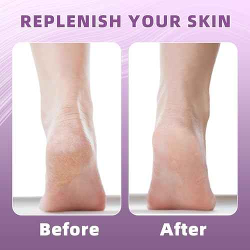 2 Pairs Silicone Socks for Dry Cracked Feet Women, Moisturizing Heel Socks, Gel Toeless Lotion Sock, Moisture Silicon Foot Sock for Cracked Heels Overnight by Untrytb