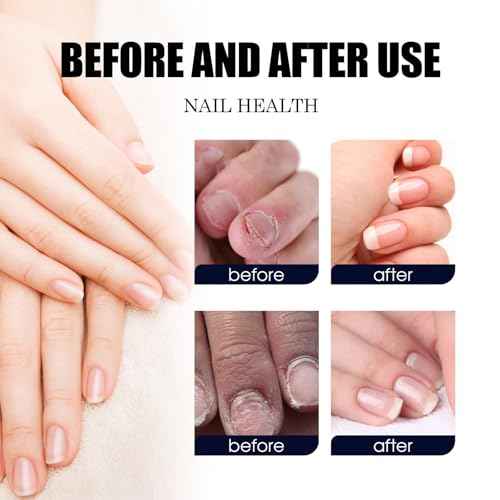Nails Spray, for Nails Care Moisturizer, Keeps Feet Fresh & Dry All Day ? Men & Women 2oz / 60ml