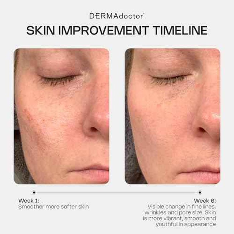 DERMAdoctor Retinol Cream for Face - Stabilized Vitamin C, Vitamin E, Ferulic Acid Anti Aging Face Cream 1% Retinol Facial Moisturizer Night-Cream for Dullness, Discoloration, Fine Lines, & Wrinkles