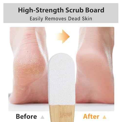 Foot Callus Remover, 2Pcs Pumice Stone Foot File with Ergonomic Wooden Handle, Pedicure Tool for Dead Skin Cracked Heels Wet Dry Use (Small)