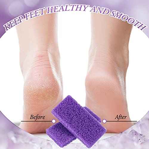 200 Pcs Disposable Foot Pumice Stone Bulk for Feet Pumice Stone Foot Scrubber Dead Skin Pedicure Scrubber Exfoliator Sponge for Feet Callus Remover Bath, Spa, 3.54 x 1.77 x 0.47 Inch(Purple, Purple)