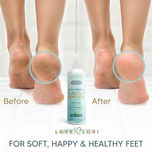 Callus Remover for Feet (Extra Strength) Foot Callus Remover Gel - Feet Scrubber, Pedicure Spa Tools, 6oz