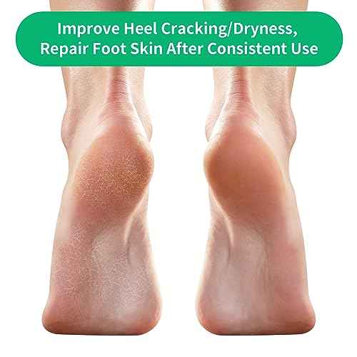Cracked Heel Treatment Repair Socks - Ohtomber 5 Pairs Silicone Gel Foot Care Softener Toeless Pedicure Moisturizing Dry Feet Socks for Dry Cracked Heels