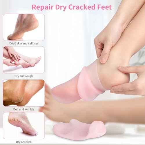 2 Pairs Silicone Moisturizing Socks for Dry Cracked Feet Women, Soft Gel Pedicure Foot Spa Aloe Socks, Anti-Slip Moisturizer Socks for Dry Cracked Feet Overnight Foot Care Pink&White