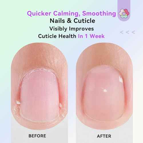 SAVILAND Soothing Cuticle Oil Pen: 6Pcs Plant-Based Nail Oil with Aloes Vitamin E Nail Strengthener Refreshing Nail Growth Serum Cuticle Softener for Moisturizing Repairing Dryness Redness Peeling