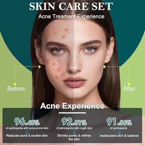 Skin Care Set,Acne Treatment for Face Skin Care Sets & Kits,Tea Tree Essential Oil Facial Skincare Gift Set with Cleanser,Toner,Serum,Gel, Acne Treatment Kit Cream Skin Care for Teens 10-12 Girls Boys