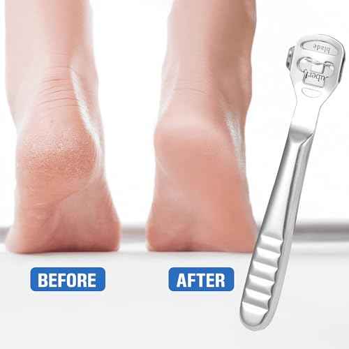 MIUKAA Callus Shaver Kit with 10 Blades, Callus Remover for Feet & Hands, Professional Dead Skin and Corn Removal Tool, Heel Scraper for Cracked Heels - Pedicure Tools for Smooth Feet