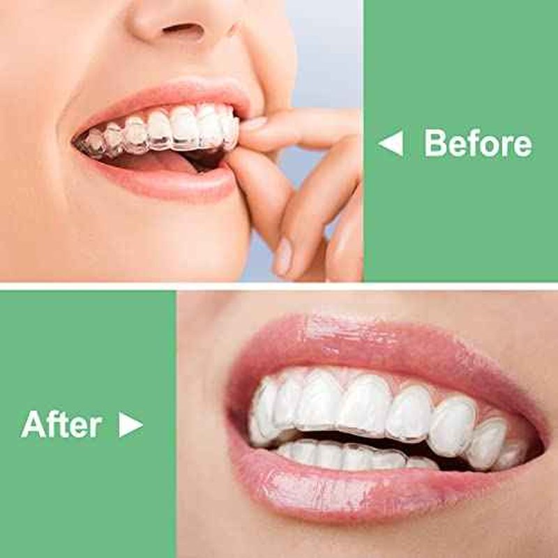 BVN Aligner Chewies, 10 Pieces Orthodontic Chewies, Retainer Chewies, Dental Chewies for Aligners, Orthodontic Dental Chewies Munchies, Green
