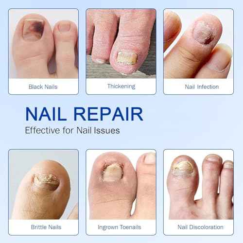 Fungal Nail Patches, Nail patches for toenails, Overnight Toe Nails Treatments for Damaged Foot Nails Repair and Care, Safe for Sensitive Skin, Easy to Apply (2)