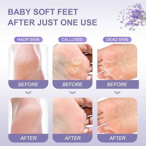 Foot Peeling Mask (5 Pack) Exfoliant for Peeling Off Calluses, Natural Exfoliator for Dry Dead Skin, Callus, Repair Rough Heels Soft Smooth Touch