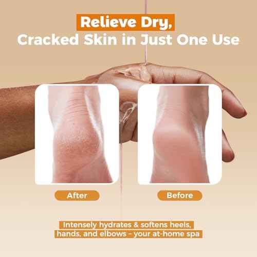 Paraffin Wax Refills 10 Packs Unscented for Paraffin Wax Bath Machine - for Dry Cracked Skin on Hands, Feet, Elbows - Moisturizing Hydration to Relieve Stiff Muscles & Joints