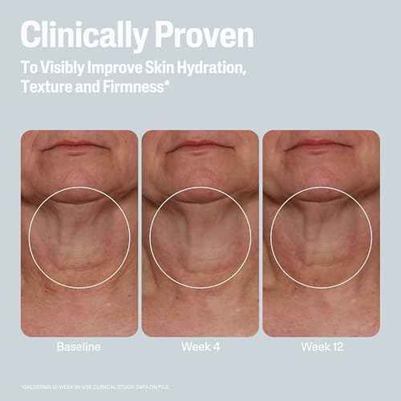 Cetaphil Skin Activator Hydrating & Firming Cream For Face, Neck & Chest 3.4 oz, Mandelic Acid (AHA) and Centella Asiatica (CICA) Cream, Hydrates and Firms Aging Skin, Anti-Aging Skincare