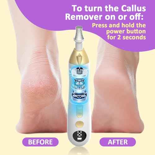 Callus Remover for Feet, Electric Foot Callus Remover - 8 Grinding Heads, 9 Speeds, Rechargeable Foot File - Professional Pedicure Tool for Hard Skin, Calluses & Cracked Feet White