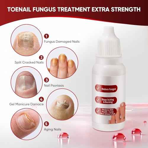 Toenail Treatment,Gentle Formula, Effectively Improves Nails for a More Beautiful Appearance