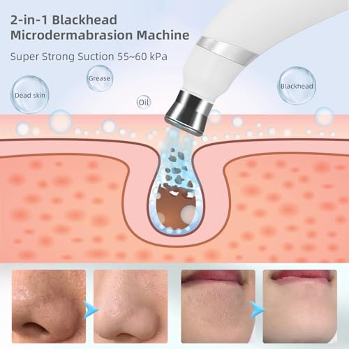 IeBilif Diamond Microdermabrasion Machine, 3 Modes Diamond Microdermabrasion Dermabrasion Machine for Blackhead Removal, Professional Portable Home Travel Microdermabrasion Device