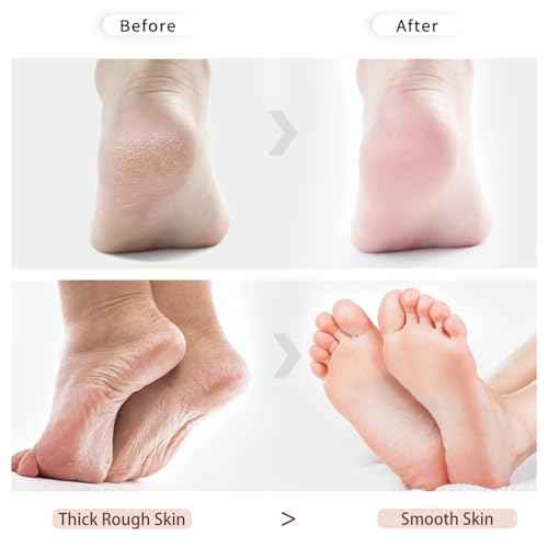 2 PCS Double-Sided for Feet, Foot Scrubber£¬Effective Pedicure Tools (Purple)