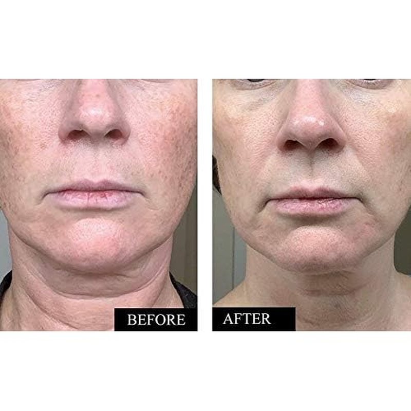 Vitamin C Serum for Face | Brightening & Anti Aging Serum for Men & Women | With Hyaluronic Acid, Vitamin E, Aloe & Jojoba | Dark Spot & Wrinkle Reducer | Made in USA | 1.7 oz | 2 Pack
