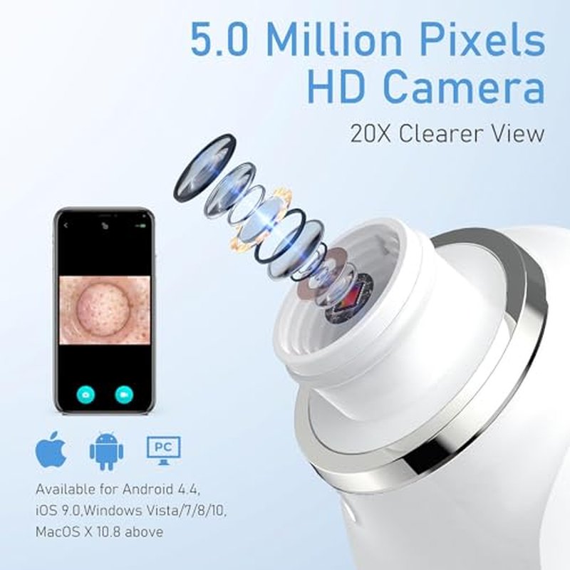 Facial Pore Blackhead Remover Vacuum, 1080P Camera Blackhead Remover, 20x Zoom, 8 LEDs £¦ 3 Suction Modes, 800mAh Battery & USB - 6 Heads Pore Cleaner Kit for Women&Men(White)
