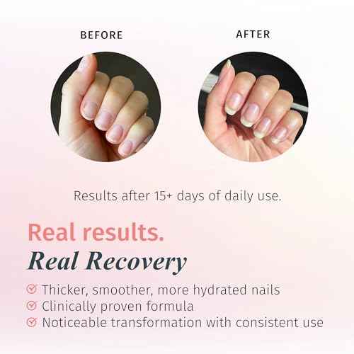 duri Rejuvacote 1 Nail Growth System - Maximum Strength | Nail Strengthener for Damaged Nails from Gel, Acrylic Manicure | Grow Long Natural Fingernails Fast - 0.45 fl. oz.