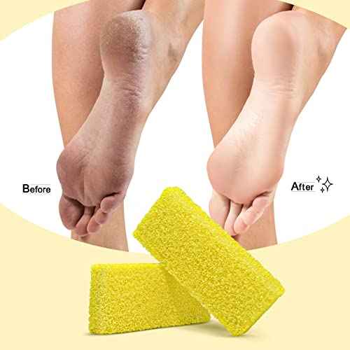 Disposable Foot Scrubber Sponge Pads Pedicure Pumice Stone for Feet Callus Remover Medium Coarse Yellow 40Pcs