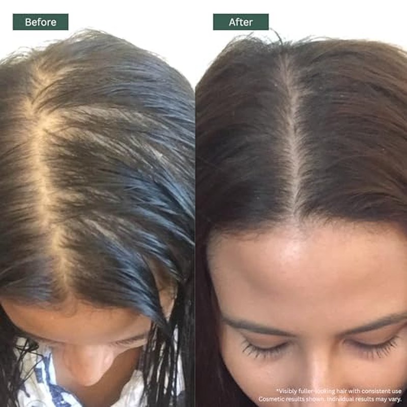 Regrowz Natural Hair Oil 3 x4.06 Fl Oz - Rosemary Hair Growth Oil with Argan & Jojoba ? Strengthen, Hydrate & Moisturise Dry, Damaged Hair ? Hair Loss Treatment