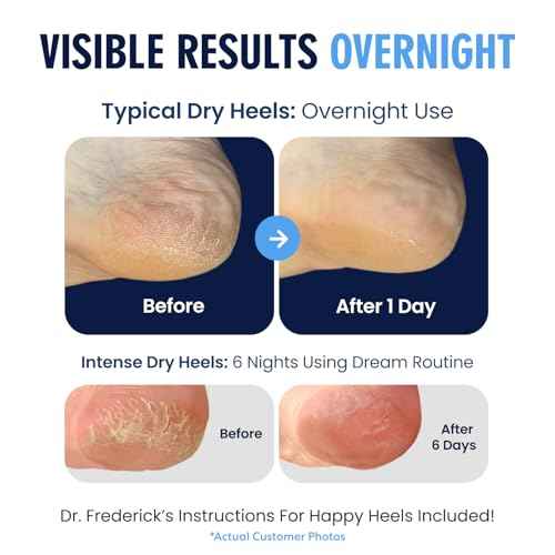 Dr. Frederick's Original Moisturizing Heel Socks for Dry Cracked Heels Treatment - Infused with Olive Oil, Jojoba Oil and Vitamin E - 2 Pairs - Stocking Stuffers for Adults - Original Formula