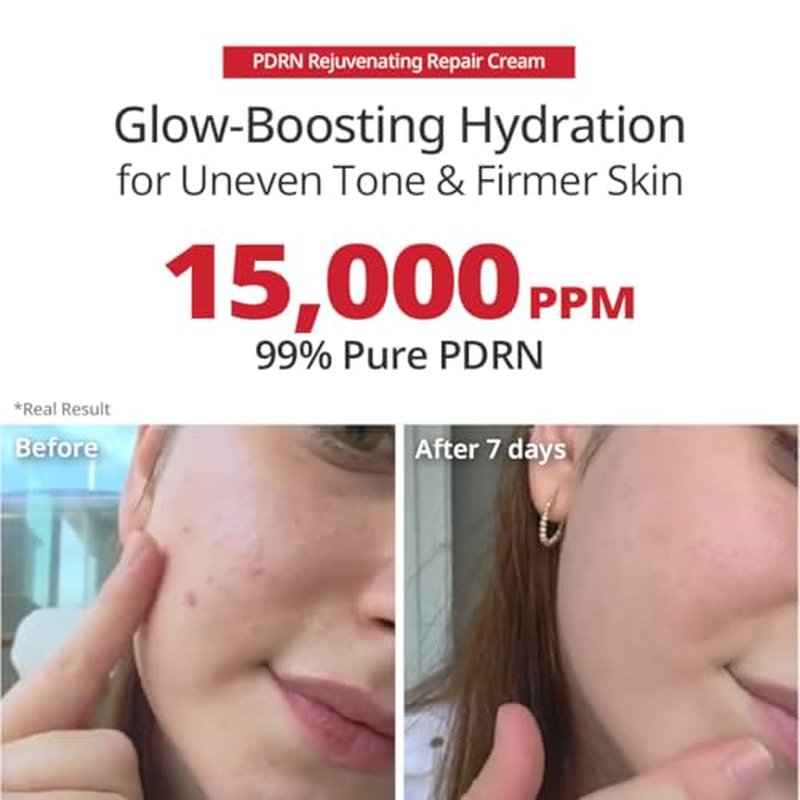 SWANICOCO PDRN Rejuvenating Repair Cream, 99.9% Pure Salmon DNA, Bakuchiol, Cica Exosome & Niacinamide, Anti-Aging, Wrinkle Care, Firming & Glow, Holiday Gift, Stocking Stuffer, 40ml / 1.35 fl oz