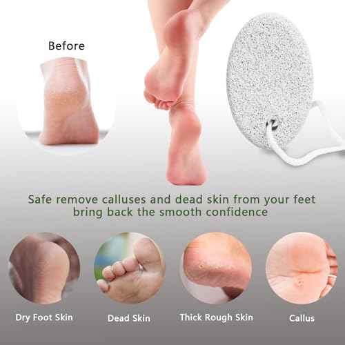 Natural Pumice Stone for Feet, Borogo 3-Pack Lava Pedicure Tools Hard Skin Callus Remover for Feet and Hands - Natural Foot File Exfoliation to Remove Dead Skin, Heels, Elbows, Hands