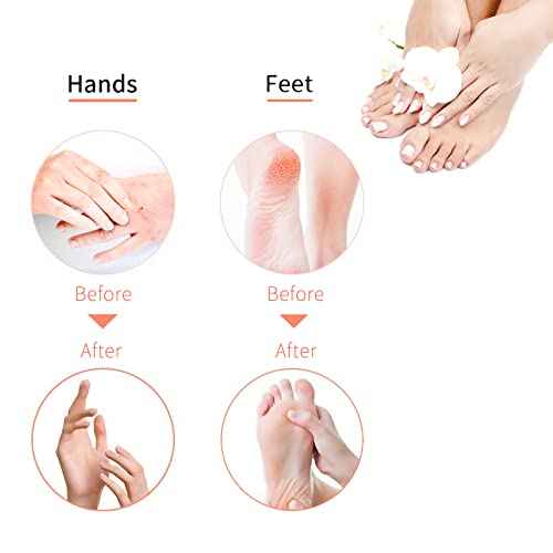 Liners Hand or Foot Disposable Thermal Heated Mitt Liners Paraffin Bath Treatments Bags Plastic Liner Socks and Gloves for Hot Wax Therapy (100)