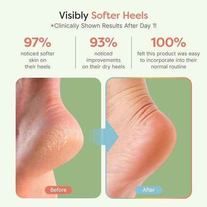 ZenToes Moisturizing Socks for Cracked Heel Treatment, Vitamin E, Olive Oil and Jojoba Oil Heel Socks, Stocking Stuffers for Women, Spa Self Care Gifts for Women (Holiday Stripes, Regular)