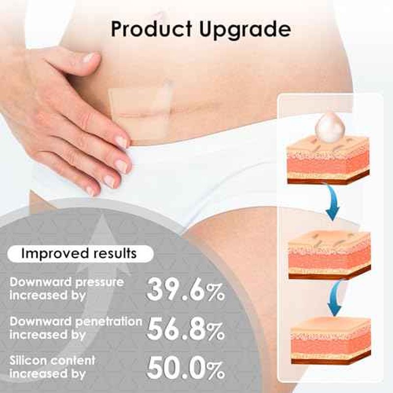 Silicone Scar Sheets,Silicone Scar Tape for Removal Treatment,Medical Grade Scar Tape for Surgical Scars,C-Section,Tummy Tuck,Scar Removal Away(1.6" x 60" Roll - 1.5M) Keloid Bump Removal