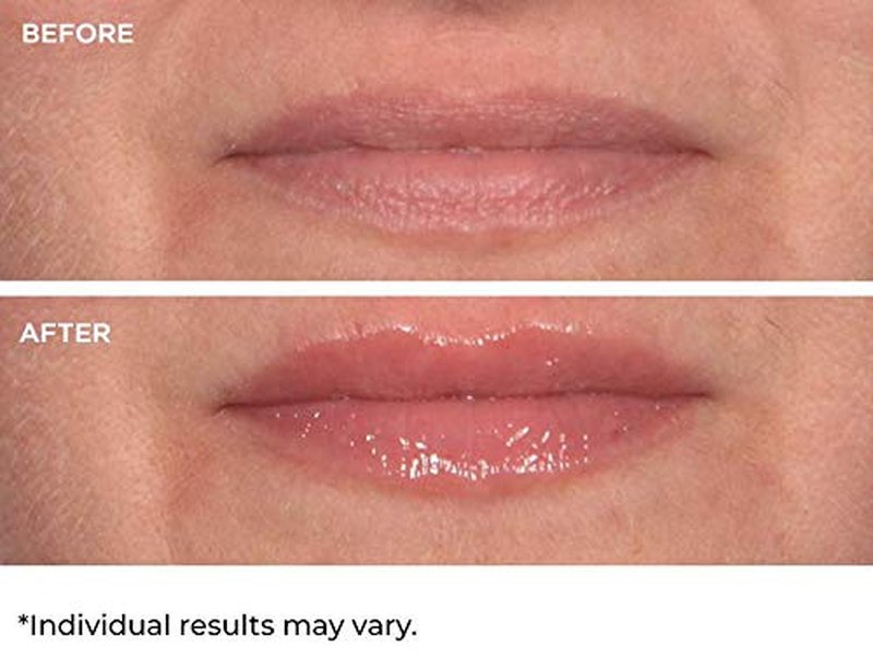 Hydro-Screen Lip Treatment - Hydrating & Nourishing Formula for Soft Lips