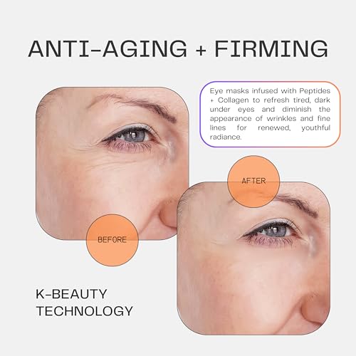 Collagen Under Eye Mask Patches (Anti-Aging + Firming 20 Pairs) with Niacinamide + Peptides - Anti-Aging, Fine Lines, Wrinkles, Dark Circles, Puffy Eyes, Under Eye Bags - Gifts - K Beauty