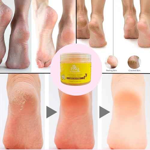Exfoliante de pies La Niquere?a - Foot Exfoliating Gel for Dry and Cracked Heels ? Deep Moisturizing Dead Skin Remover ? Softens and Smooths Feet