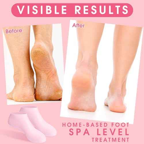 XANGNIER 6 Pairs Silicone Socks for Dry Cracked Feet Women,Moisturizing Foot Mask Exfoliating Silicone Socks,Foot Spa Gel Socks for Cracked Heels,Softening Rough Skin and After Pedicure Care