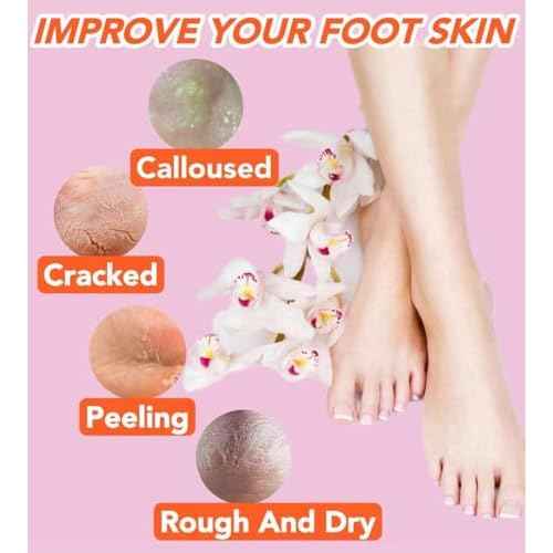 2 Pairs Silicone Socks for Dry Cracked Feet Women,Silicones Moisturizing Socks,Foot Spa Pedicure Silicone Socks for Repairing Dry Feet,Cracked Heels and Softening Rough Skin(Fits Size 8 to 11)
