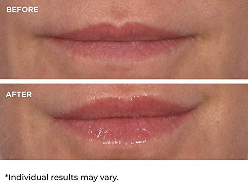 Hydro-Screen Lip Treatment - Hydrating & Nourishing Formula for Soft Lips