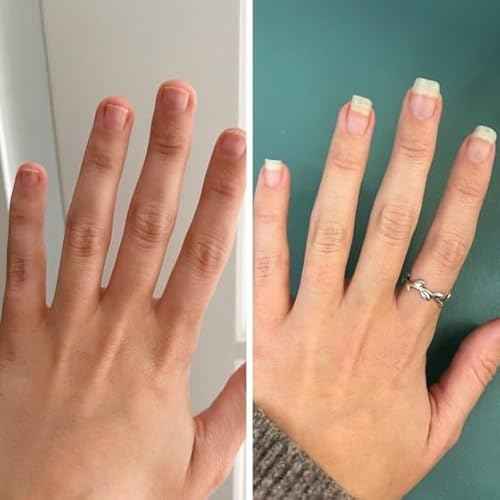 Mavala Mavaderma Nourishing Massage Oil for Nails, Nail Care, Nail Hardener, Cuticle Oil Nail Growth, Moisturizing & Healing Treatment for Cracked Nails & Rigid Cuticles (0.3 Ounce)