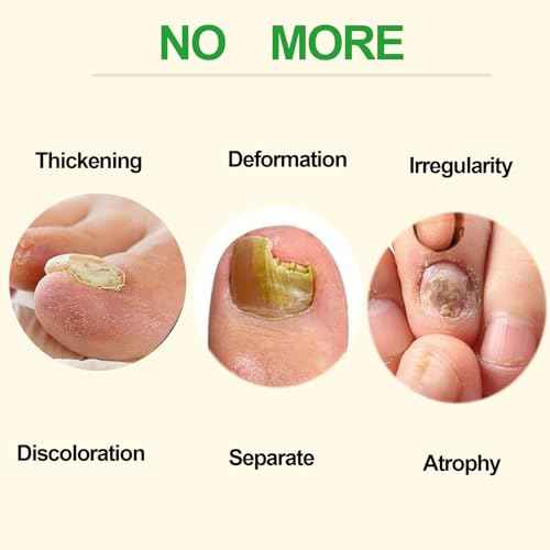 Ginger Nail Treatment Serum Oil, Nail Regrowth Serum, Nutrient Oil for Nail Cuticle Repairing, Promoting Regrowth, Strengthening, Plant-Based Formula with File Tool