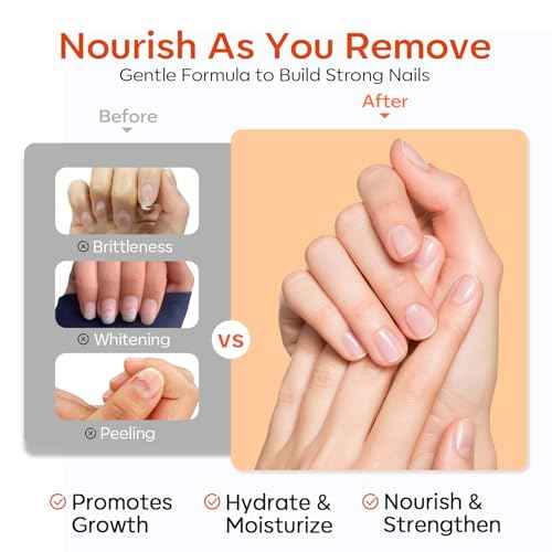 Modelones Semi-Cured Gel Nail Strip Remover | Nail Glue Remover Easy Peel Gel Strips, Press on Nails and Nail Polish | Gentle, Non-Drying, Nourishing and Hypoallergenic Acetone-Free Formula 50ML