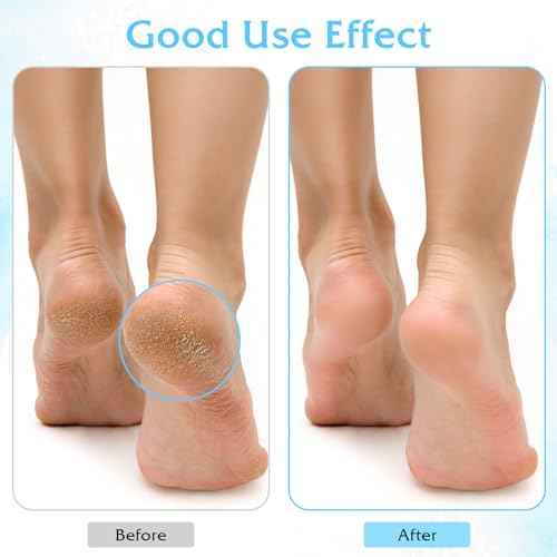 3Pairs Aloe Socks Moisturizing Spa Socks for Dry Cracked Feet Infused Socks Gel Sleeping Fuzzy Socks Lotion Socks Gift for Women Softening Dry Feet, Pink&blue&green